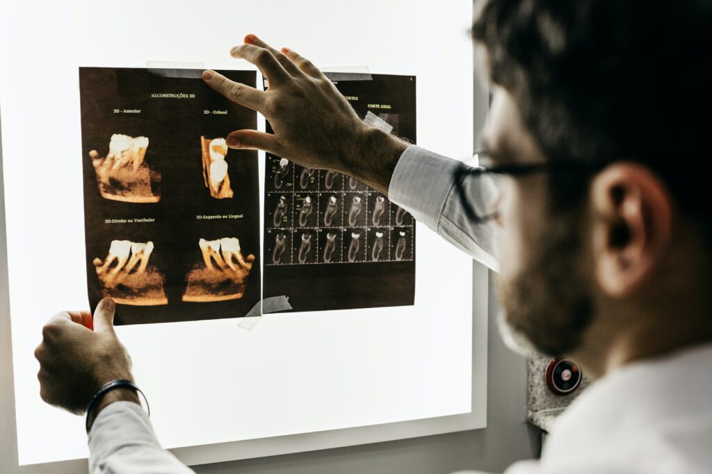 インプラント治療後はMRI検査ができないのか？