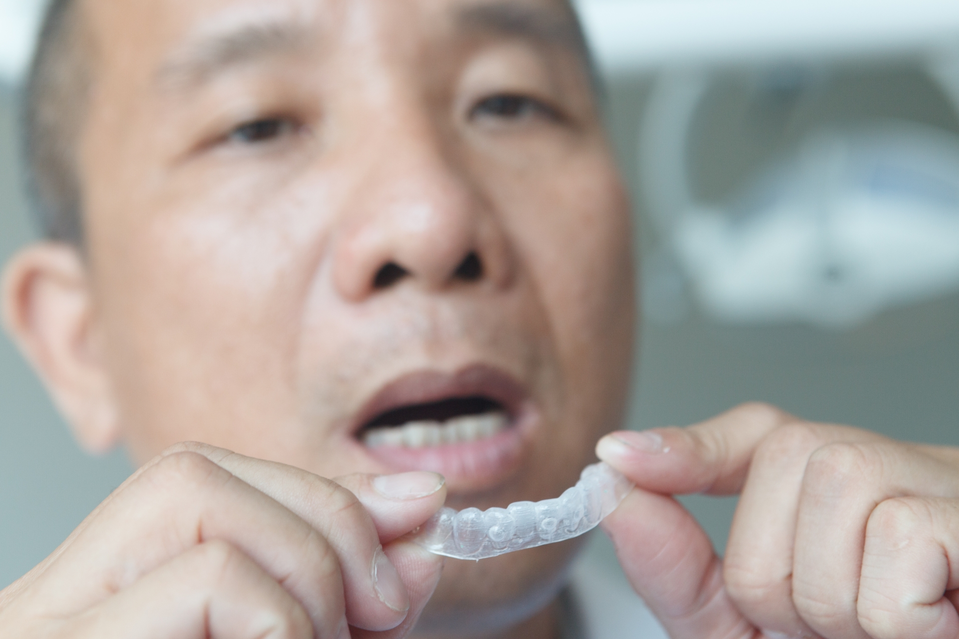 歯ぎしりはマウスピースで治る？原因や治療法について解説