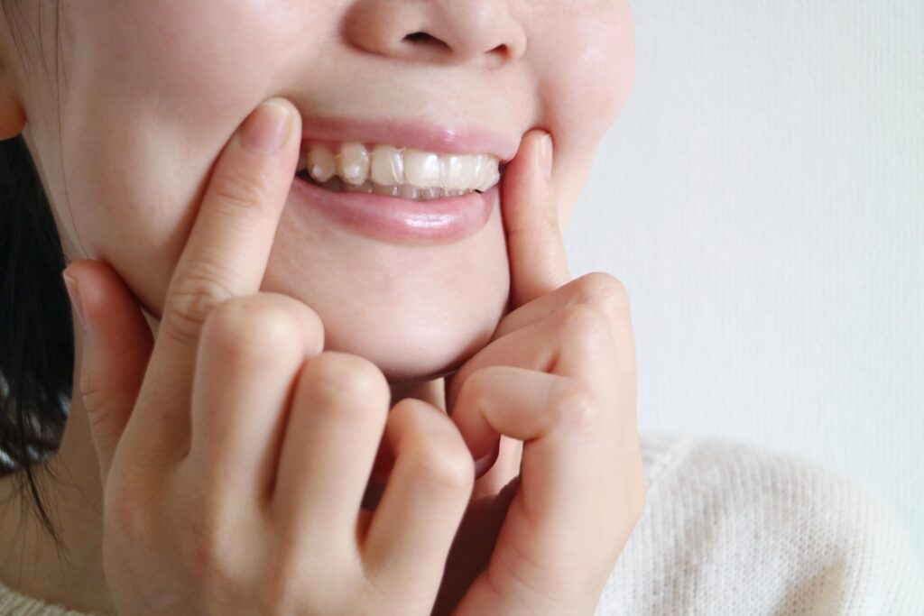 インビザライン矯正で抜歯なしの治療をする方法