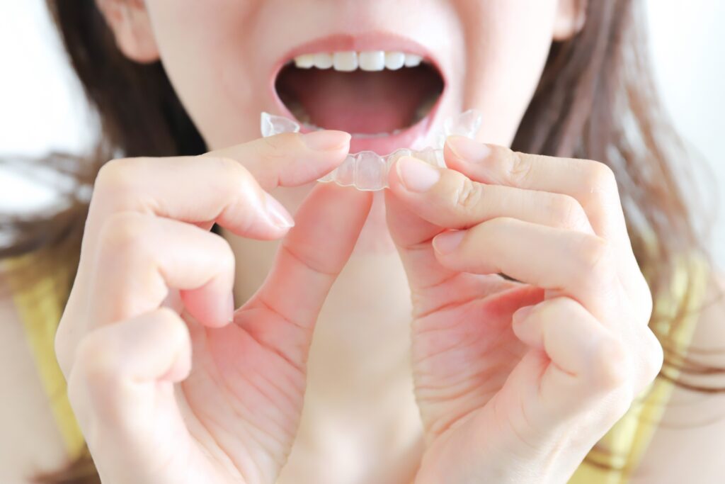 歯が動きにくくても歯列矯正を早く終わらせる方法